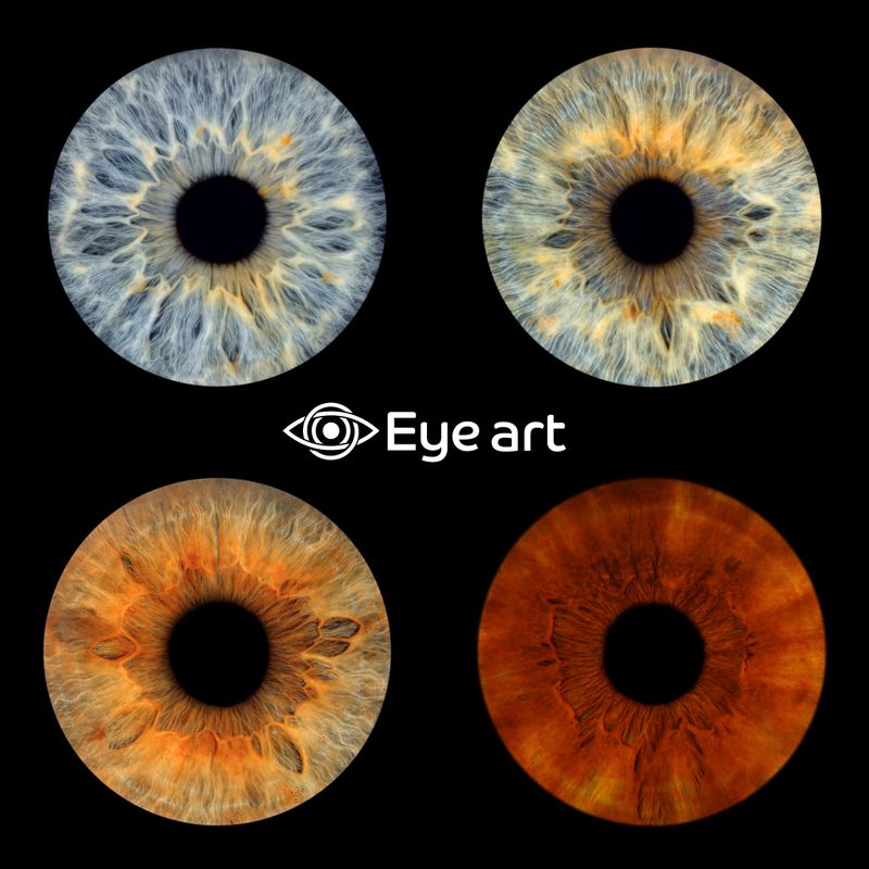 Akių fotografija EYEART